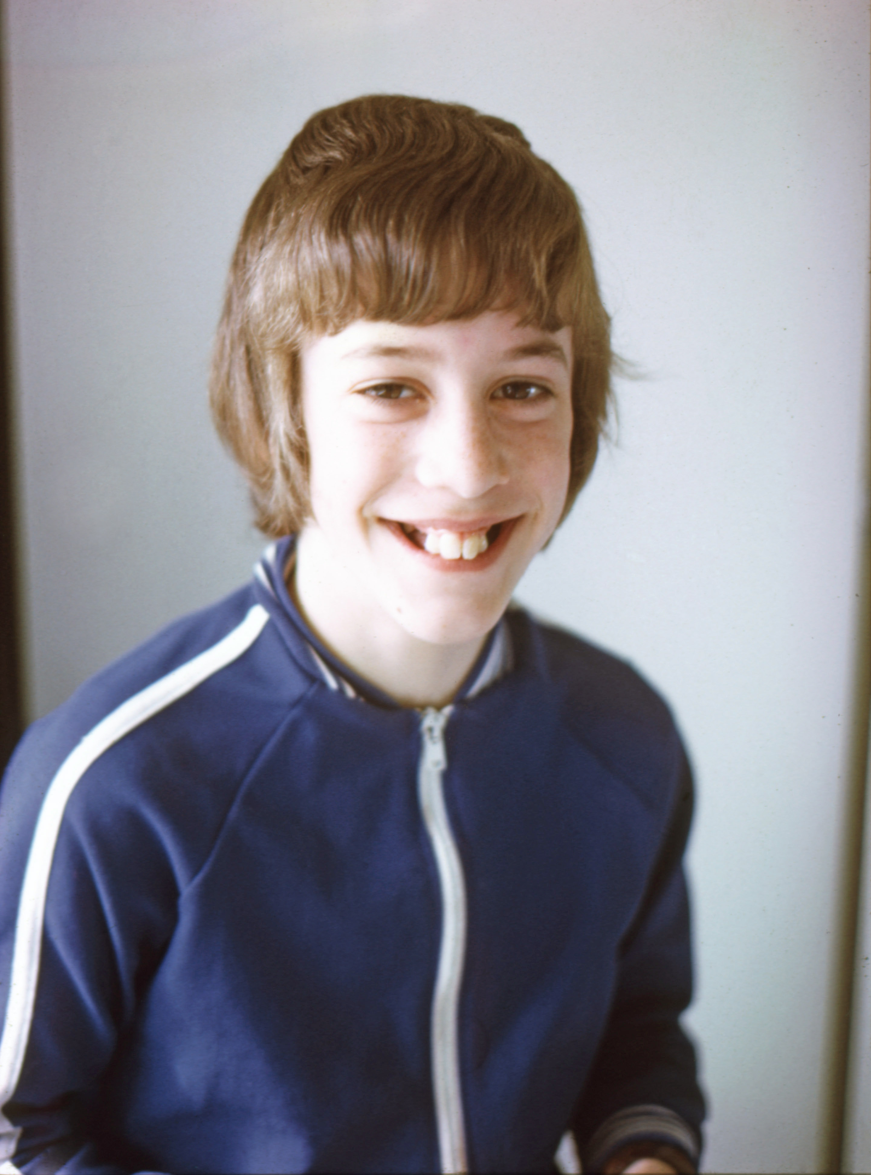 7706140 August 1977 - John has recently had his side teeth removed prior to orthodontic treatment.